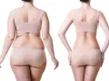 Liposukcja: Ile kg tłuszczu usuniesz? Modeluj, nie odchudzaj!
