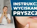Jak wycisnąć pryszcza? Poradnik eksperta: Bezpiecznie i bez blizn