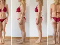 Liposukcja: Co to jest? Przewodnik po odsysaniu tłuszczu