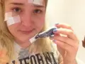 Maść ichtiolowa na pryszcze: Jak bezpiecznie i skutecznie stosować?