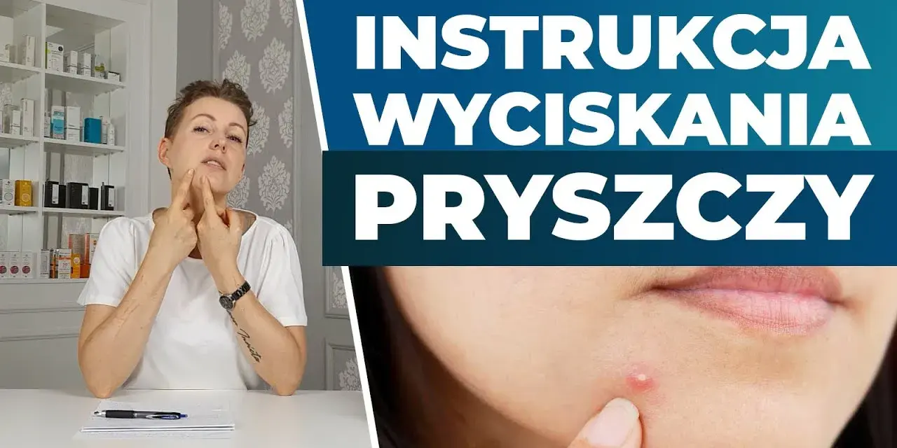 Jak wycisnąć pryszcza? Poradnik eksperta: Bezpiecznie i bez blizn