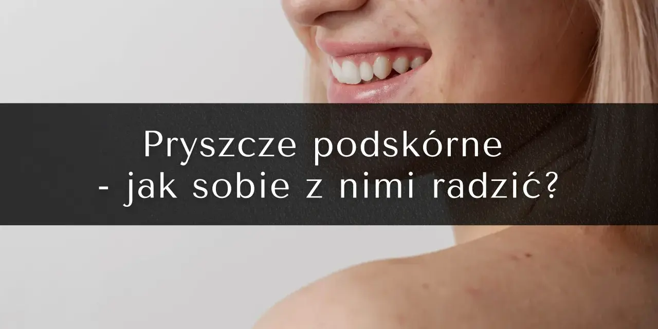 Pryszcze podskórne: Koniec z bólem! Skuteczne metody leczenia