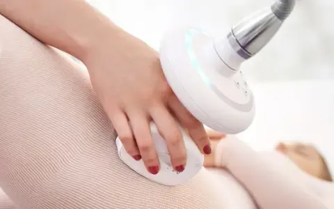 Endermologia: Co musisz wiedzieć o redukcji cellulitu i ujędrnianiu?