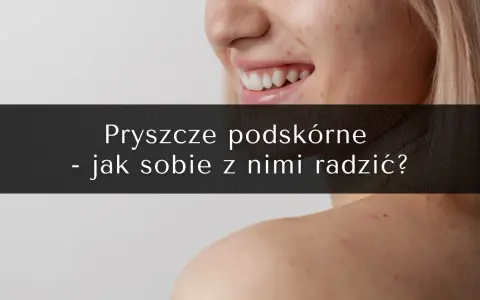 Pryszcze podskórne: Koniec z bólem! Skuteczne metody leczenia