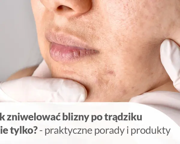 Pozbądź się śladów po pryszczach: skuteczne metody i porady
