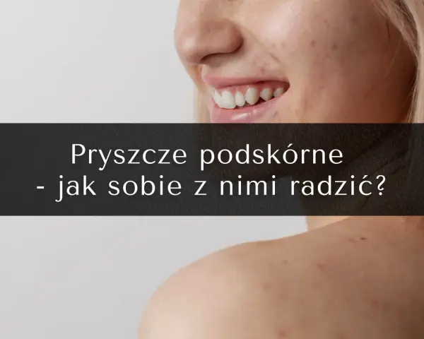 Pryszcze podskórne: Koniec z bólem! Skuteczne metody leczenia