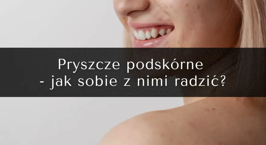 Pryszcze podskórne: Koniec z bólem! Skuteczne metody leczenia