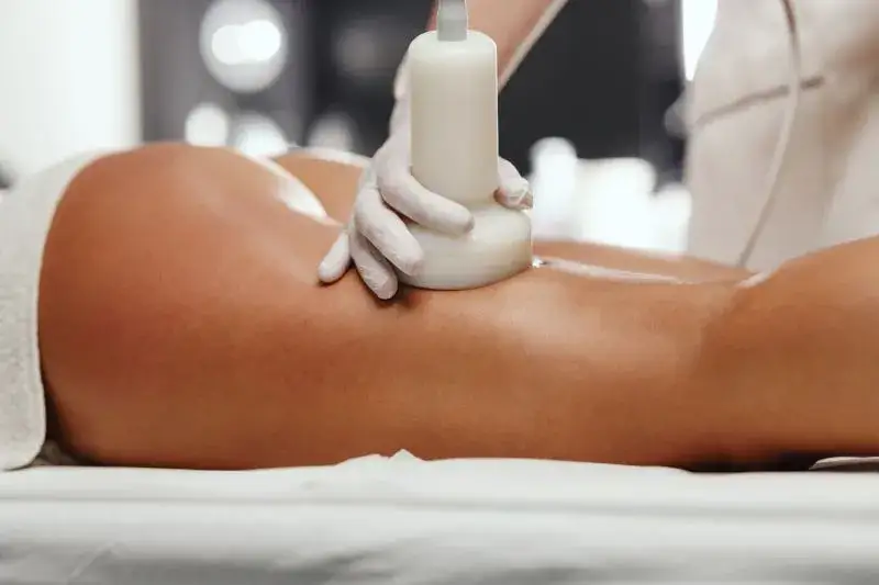 Zdjęcie Endermologia: Co musisz wiedzieć o redukcji cellulitu i ujędrnianiu?