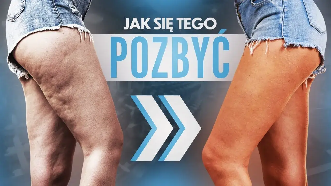 Zdjęcie Jak skutecznie pozbyć się cellulitu? Kompletny poradnik Heleny Dudek